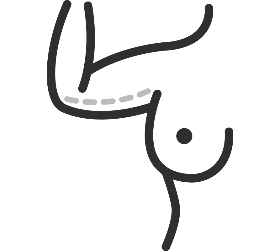 Arms - Areas we Treat | DermaClinic Center - We are Leaders in Aesthetic Treatments