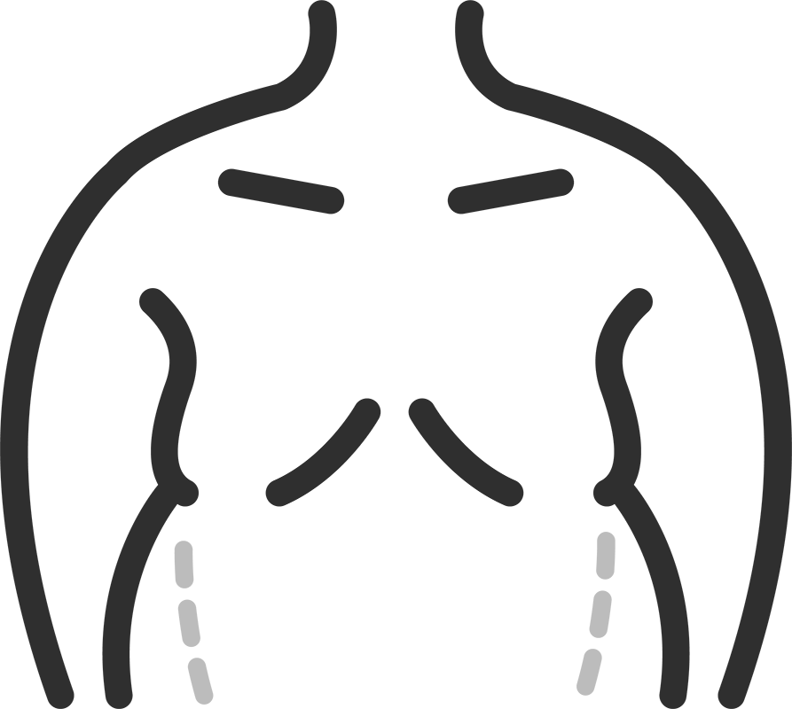 Back - Areas we Treat | DermaClinic Center - We are Leaders in Aesthetic Treatments