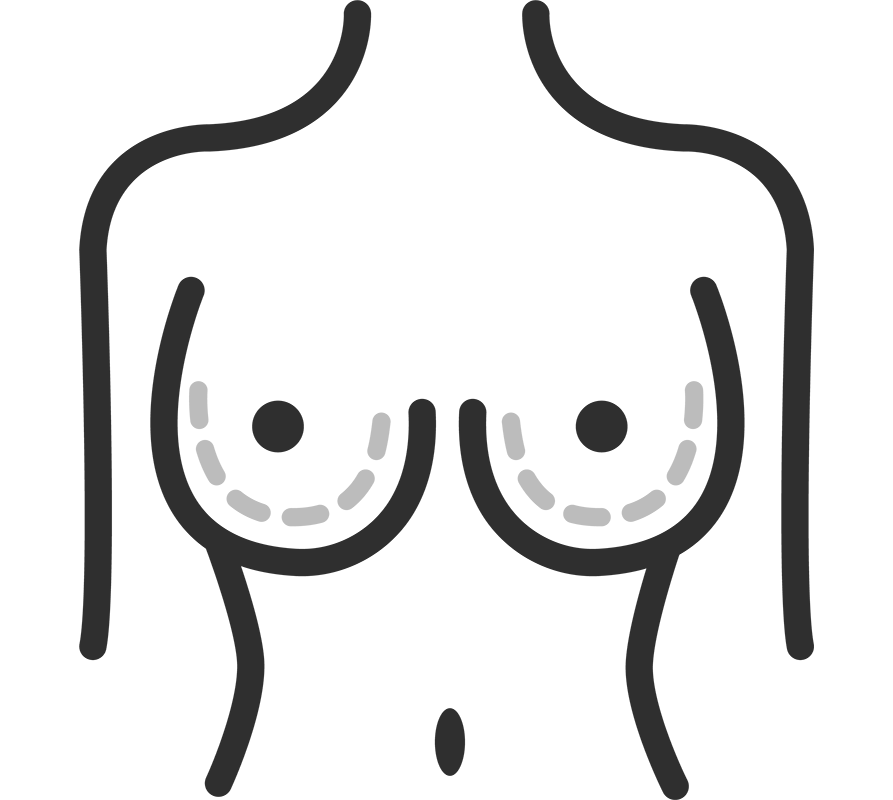 Chest - Areas we Treat | DermaClinic Center - We are Leaders in Aesthetic Treatments
